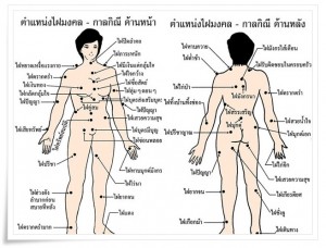 ไฝ ไฝ-ปาน